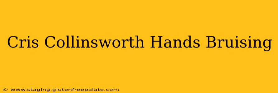 Cris Collinsworth Hands Bruising